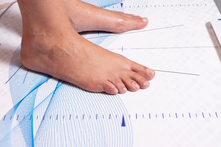 What is a Biomechanical Assessment, and do you need one